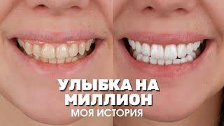 Виниры в Турции в 2 раза дешевле. Реальный отзыв о Myra Dental Clinic. Цены стоматологии Анталии.